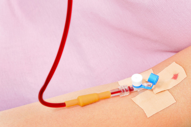 Transfuzja krwi - Zdjęcie, obraz