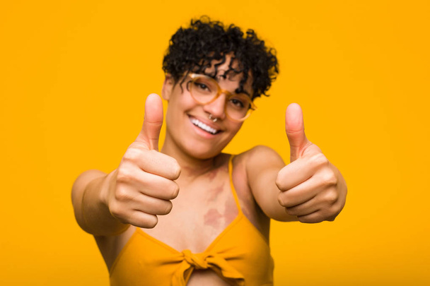 Молода афроамериканець жінка з знаком народження шкіри з великими пальцями UPS, ура про щось, підтримка та повага концепція. - Фото, зображення