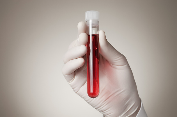 Mão de médico com amostra de sangue
 - Foto, Imagem