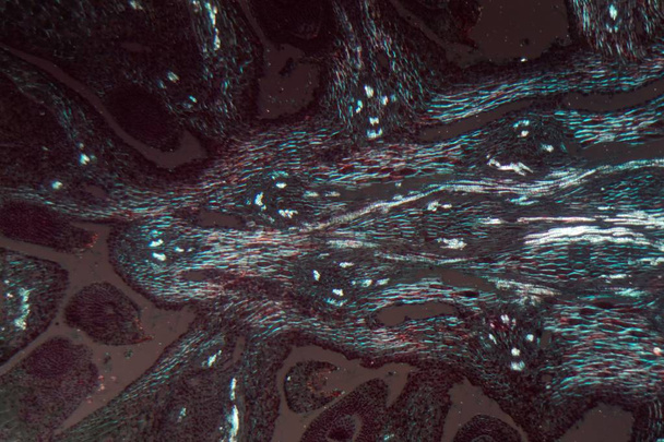 Żeńskie stożek sosny pod mikroskopem i w świetle spolaryzowanym - Zdjęcie, obraz