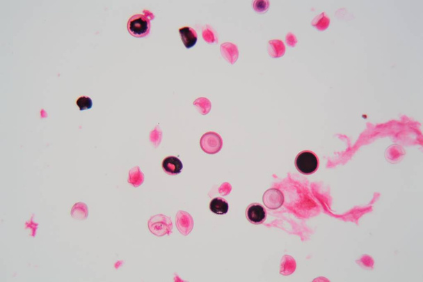 Eggs of a Taenia tapeworm - Photo, Image