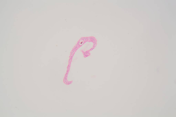 顕微鏡下のシストソーママンソニ寄生虫. - 写真・画像