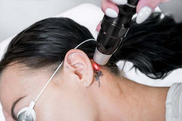 Séance de traitement de retrait de tatouage au laser sur le patient, en utilisant la technologie picoseconde, pour décomposer l'encre de tatouage en particules plus petites. Dans une clinique de beauté et de soins pour lasers esthétiques
. - Photo, image