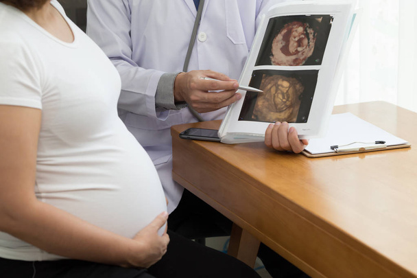 Docteur tenant le résultat de l'échographie 4D et parlant à la femme enceinte. Concept pendant la grossesse
 - Photo, image