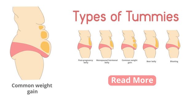 Types of female tummies banner - Vector, Image