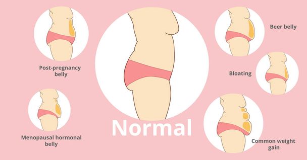 Tipos de pancartas de barrigas femeninas
 - Vector, Imagen