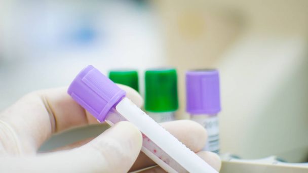 Пурпурная пробирка EDTA завершает анализ крови и гепатит лития
 - Фото, изображение