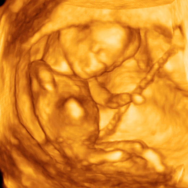 ultra-som bebê
 - Foto, Imagem