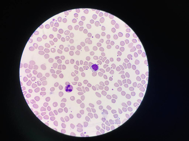 Comparaison globules blancs Neutrophile et lymphocyte
. - Photo, image