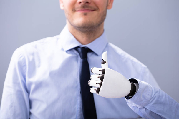 Businessperson With Prosthetic Limb Showing Thumb Up. Artificial Limb - Foto, Imagem