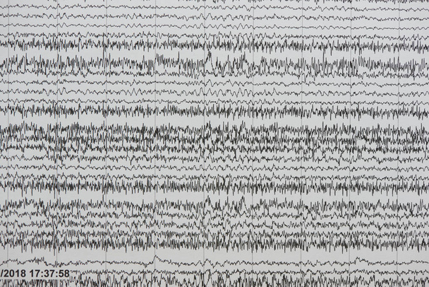 Antecedentes das ondas cerebrais no papel
  - Foto, Imagem