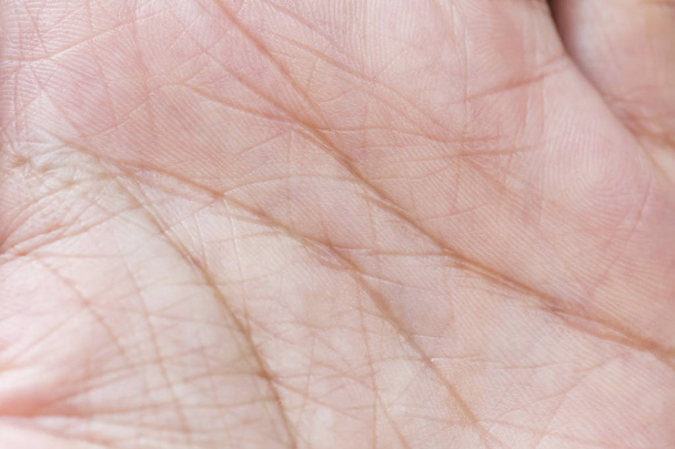 Отпечаток пальца указывает на личность человека, а также используется для представления судьбы владельца отпечатка пальца.
. - Фото, изображение