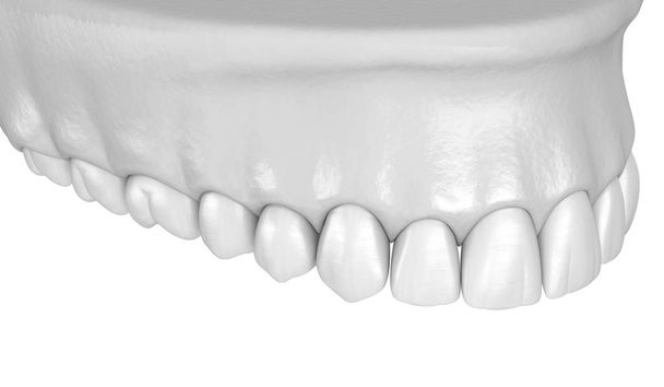 Oberkiefer menschliches Zahnfleisch und Zähne in weißem Stil. medizinisch korrekte 3D-Abbildung der Zähne - Foto, Bild