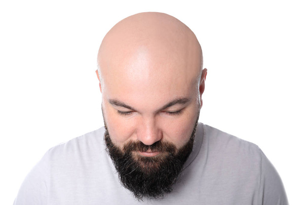 Man with hair loss problem on white background - Foto, Imagen