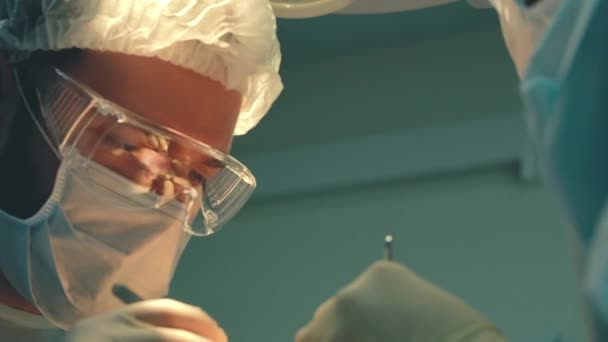 Kaalheid behandeling. Haartransplantatie. Chirurgen in de operatiekamer voeren haartransplantatiechirurgie uit. Chirurgische techniek die haarfollikels van een deel van het hoofd beweegt. - Video