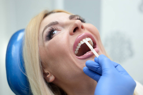 kadın diş hekiminde diş gölgenotu kontrol - Fotoğraf, Görsel