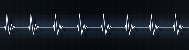 tlukot srdce na ECG - Fotografie, Obrázek