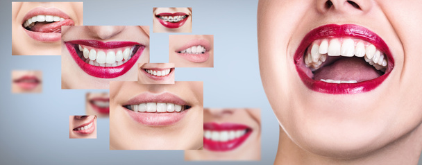 Giovane donna vicino collage con denti di salute
. - Foto, immagini