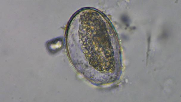 Macro Gnathostoma spinigerum oeufs dans les selles examen
. - Photo, image