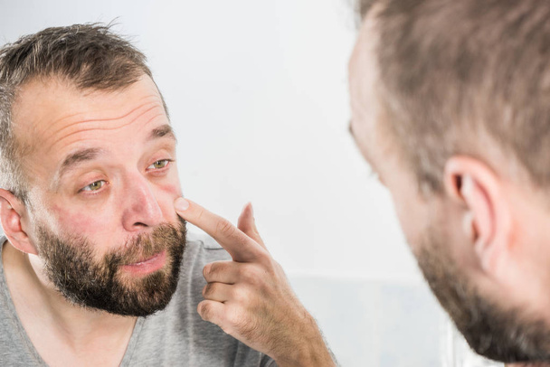 Man looking at wrinkles on his face - Fotoğraf, Görsel