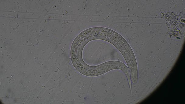 Strongyloides stercoralis larve in het onderzoek van de ontlasting. - Foto, afbeelding