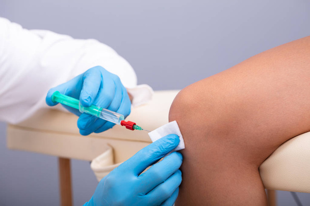 Close-up Of A Cosmetologist Wearing Blue Surgical Gloves Makes Rejuvenation Beauty Injection On Woman's Knee - Photo, Image