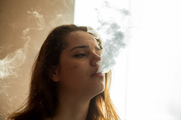 Vape teenager with  problem skin. Portrait of young cute girl smoking an electronic cigarette in the bar. Bad habit that is harmful to health. Vaping activity. - Foto, Imagem