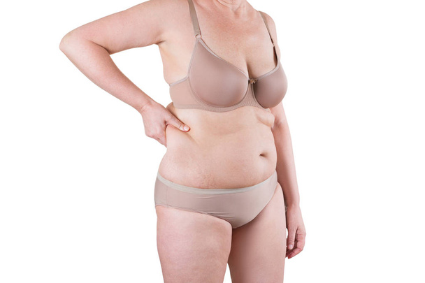 Tummy tuck, flabby skin on a fat belly, plastic surgery concept - Photo, image