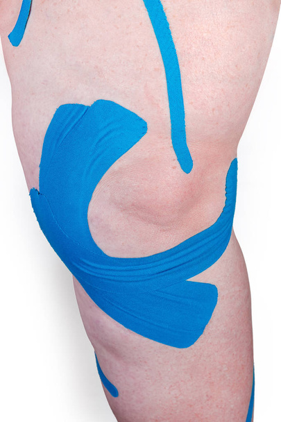 Rubans thérapeutiques élastiques bleus collés autour du genou féminin
 - Photo, image