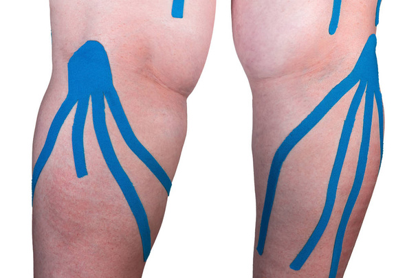Nastri terapeutici elastici blu incollati sulle gambe femminili
 - Foto, immagini