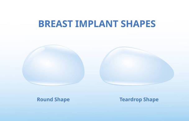 Implant piersi, kształt silikonowy, okrągły kształt i łzy - Wektor, obraz