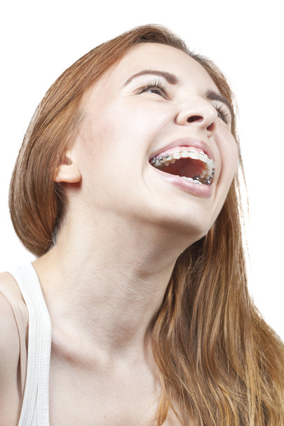 Girl with braces - Foto, Imagem