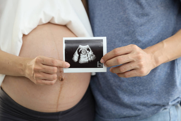 close up shot of young pregnant belly wife and husband hands holding ultrasound film  - Photo, image
