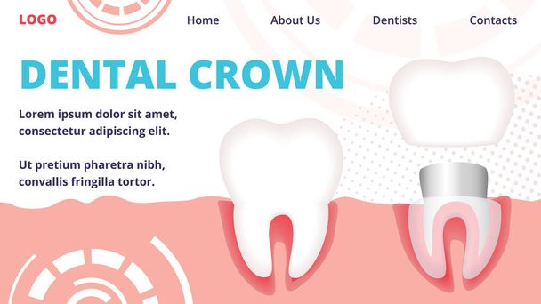 Dental Crown Horizontal Banner. Tooth Restoration - Vector, Image