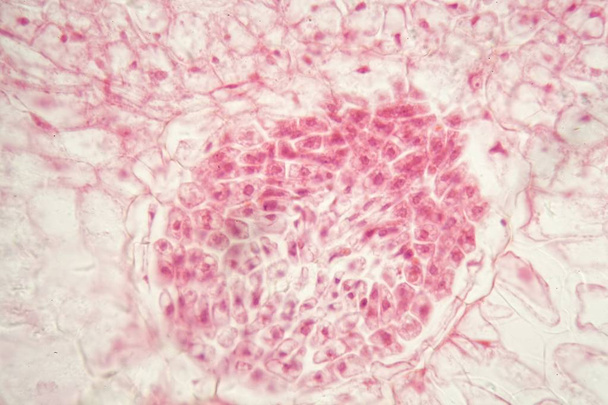 Kořenové bakterie uzliny pod mikroskopem. - Fotografie, Obrázek
