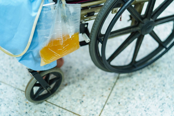 Mujer asiática de mediana edad sentada en silla de ruedas con bolsa de orina en la sala del hospital: concepto médico saludable
 - Foto, imagen