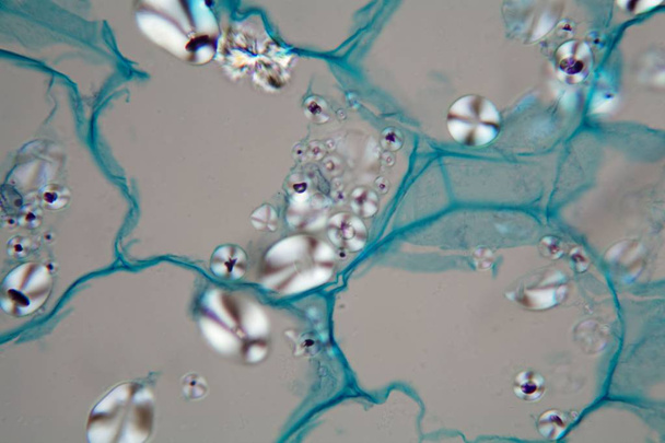 顕微鏡下でデンプントウモロコシを含むジャガイモ細胞 - 写真・画像