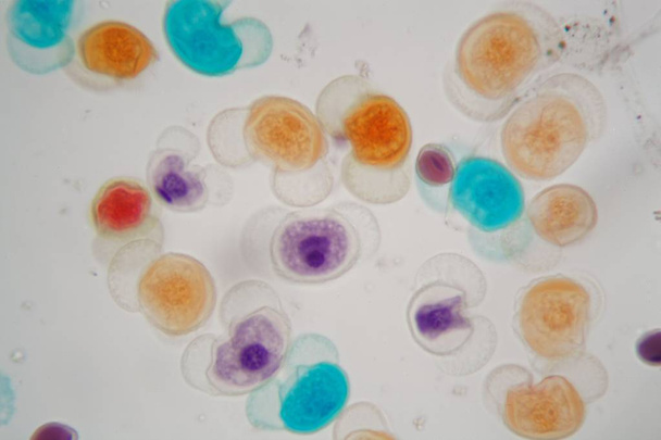 Grains de pollen de différentes espèces au microscope
 - Photo, image