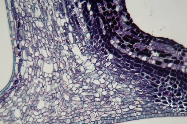 Φυτικά κύτταρα μολυσμένα από ένα παράσιτο φυτό κάτω από το μικροσκόπιο. - Φωτογραφία, εικόνα