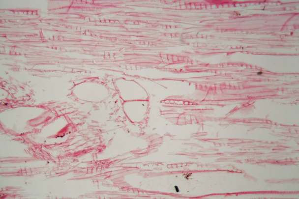 Vom Pilz zerstörte Holzzellen unter dem Mikroskop - Foto, Bild