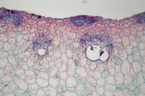 Φυτικά κύτταρα με βλάβες που προκαλούνται από ένα παρασιτικό ζώο κάτω από το μικροσκόπιο - Φωτογραφία, εικόνα