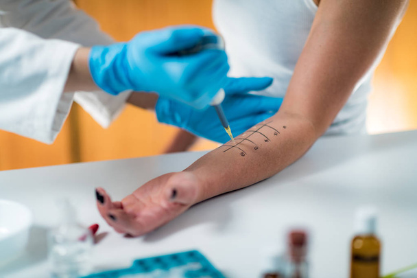 Immunologe testet Allergiereaktion am Arm einer Frau  - Foto, Bild