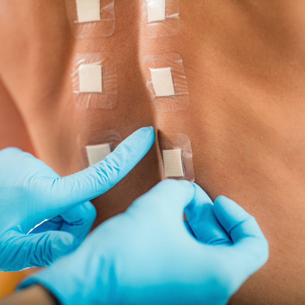 Ανοσολόγος κάνει το δέρμα τσίμπημα αλλεργία δοκιμή σε μια Γυναίν πίσω  - Φωτογραφία, εικόνα