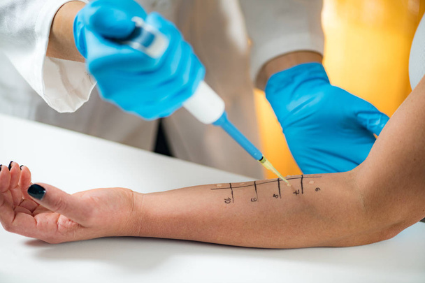 Allergy - Skin Prick Tests on a Womans Arm  - Foto, afbeelding