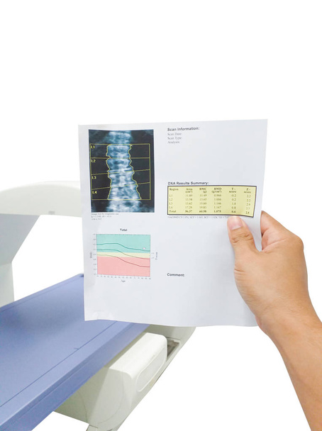 Speciální vyšetření Hand doctor look results spine bone density.too rozmazanost a artefakt image - Fotografie, Obrázek