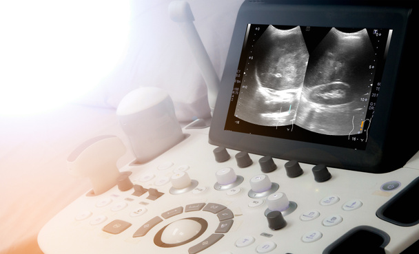 a medical equipment background, close-up ultrasound machine - Photo, Image