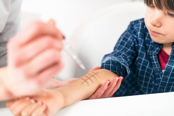Allergia - Test del trucco della pelle sul braccio dei bambini
 - Foto, immagini