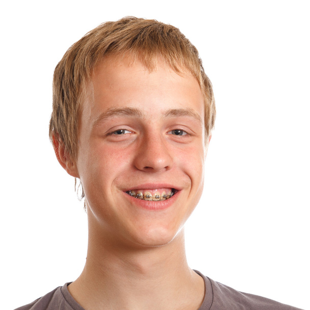 adolescente sonriente con frenos dentales
 - Foto, imagen