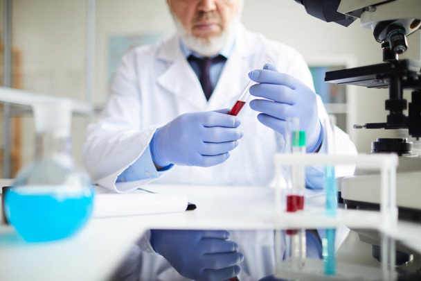 Primer plano del médico en guantes protectores sosteniendo el tubo de ensayo con sangre mientras trabaja en la mesa en el laboratorio
 - Foto, Imagen