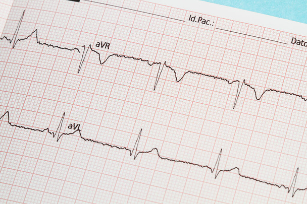 Papírba nyomtatott elektrokardiogram része - Fotó, kép